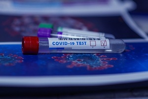 £149m to support increased care home testing
