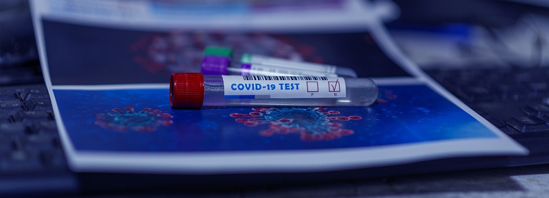 £149m to support increased care home testing