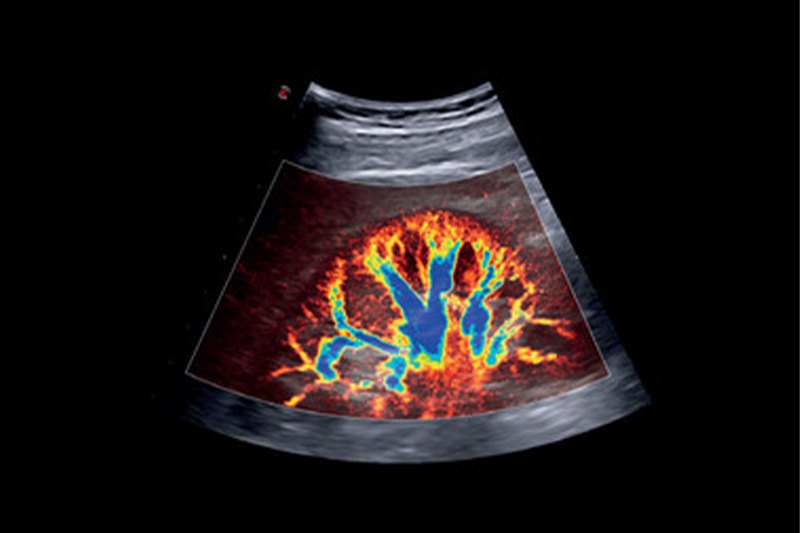 A new era for ultrasound technology emerges in European healthcare
