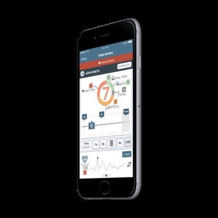 AI health deterioration detection start-up wins £1m NHS contract