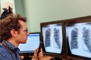 AI imaging collaboration speeds up COVID triage 