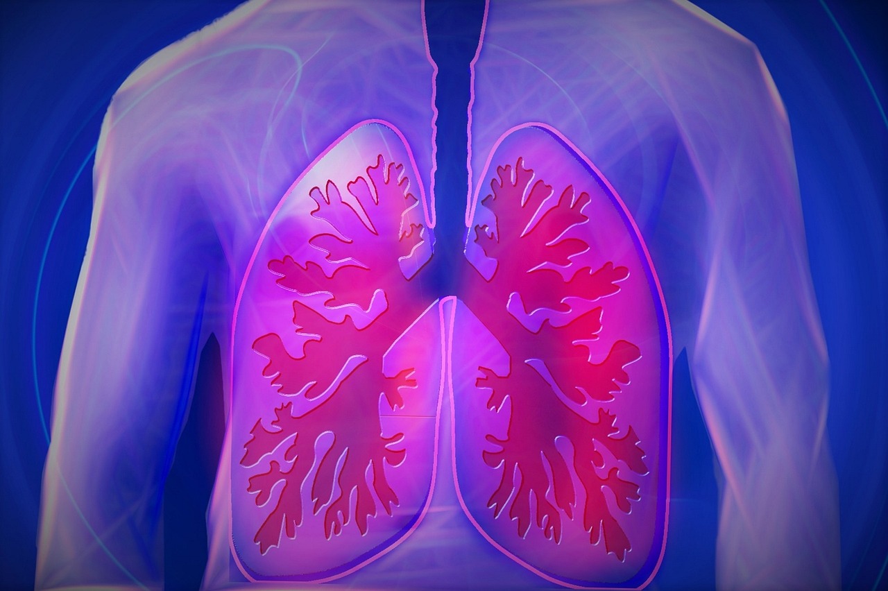 Lung cancer is the most-common type of cancer in the world, leading to more than 1.8 million deaths a year