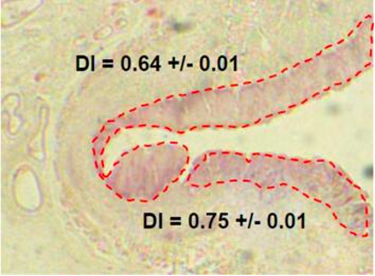 The traditional H&E staining approach comes at a huge cost to the NHS as cancer biopsy results have to be flown to the US for analysis