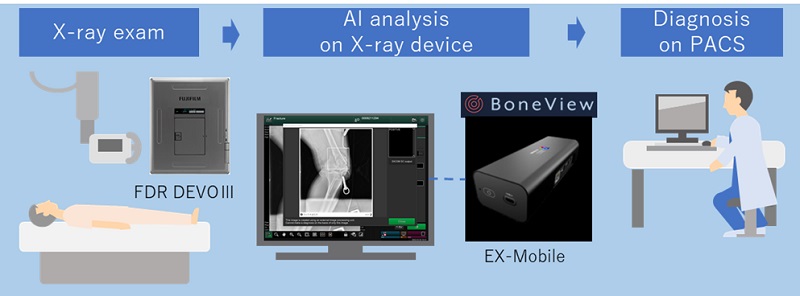 Boneview has been integrated into Fujifilm's X-ray solution to provide results within 30 seconds at the point of care