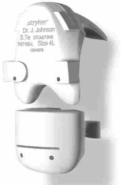 OtisMed ShapeMatch Joint ventures