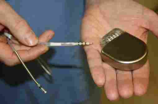 DF-4 implantable defibrillator News round-up