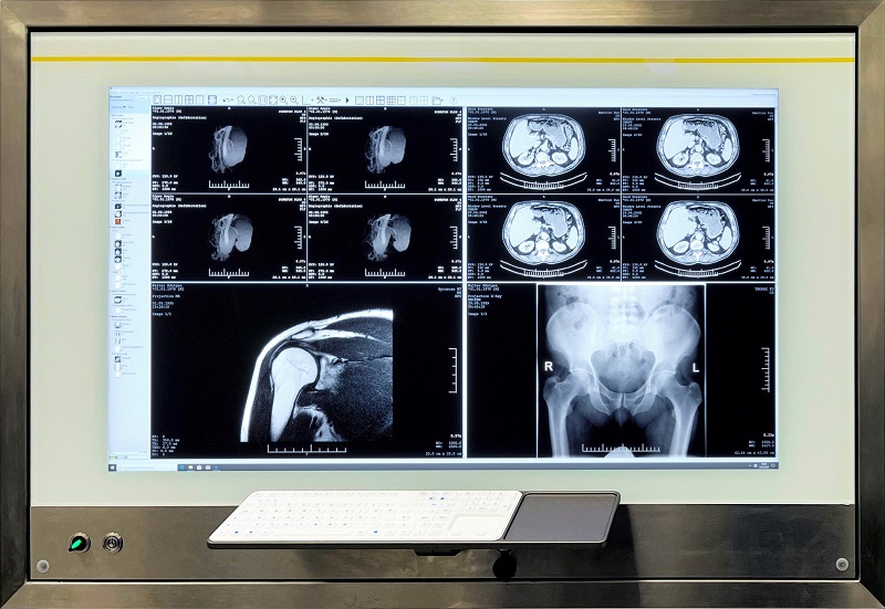 The Console enables clinicians to view high-quality scans