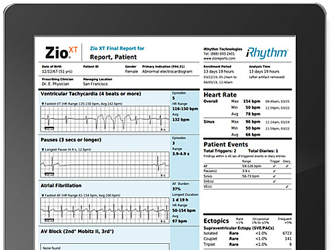 iRhythm Zio could have a major impact on current testing protocols for heart conditions