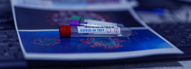 Breakthrough in COVID-19 testing