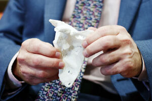Case study: Instant surgical planning with low-cost 3D printed bone models
