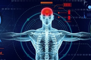 Cheshire and Merseyside clinical network launches pioneering AI stroke project