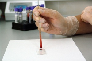 Digital breakthrough will revolutionise clinical trial management