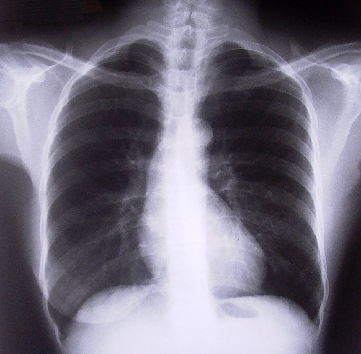 Eighth hospital trust joins radiology consortium