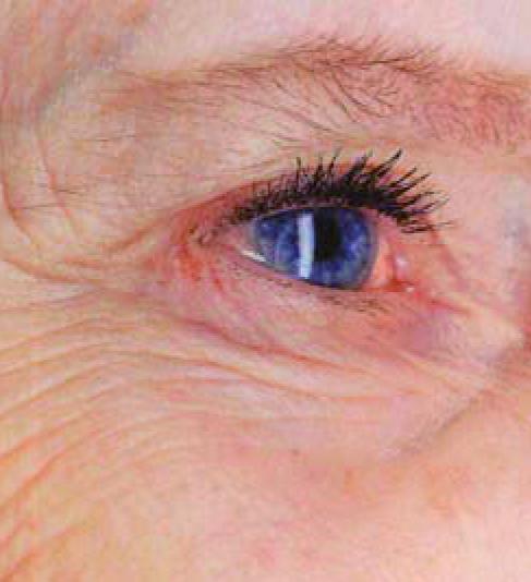 Electronic optometry referral service for Wales