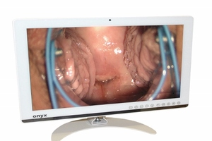 Global launch for gynaecological workstation