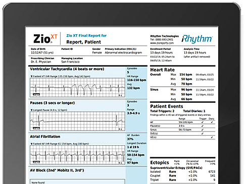 iRhythm launches in UK to tackle growing vascular health challenges