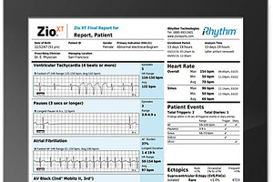 iRhythm Technologies announces NHS funding for cardiac monitoring device