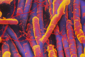 Kent trust faces £1.5m-plus fine after failing to control C.difficile
