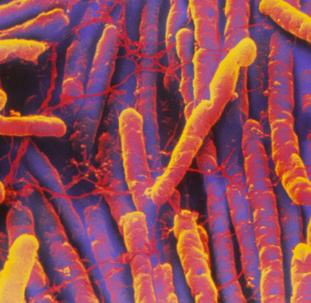 Kent trust faces £1.5m-plus fine after failing to control C.difficile