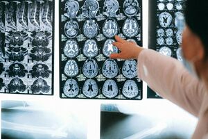 Kings College and two NHS trusts join forces to launch new cardiac Photon-Counting CT scanner