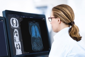 Launch of one of the largest diagnostic imaging initiatives in the NHS