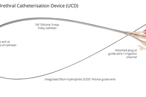 Medtech Innovation Briefing: Urethrotech UCD for difficult or failed catheterisation