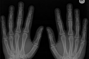 National imaging system extended across Ireland