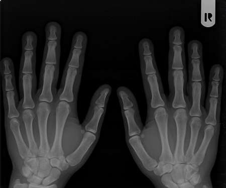 National imaging system extended across Ireland