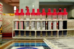 New blood test to detect liver damage in under an hour