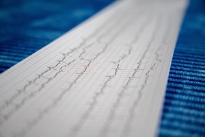 New prototype app revolutionises care for cardiac patients