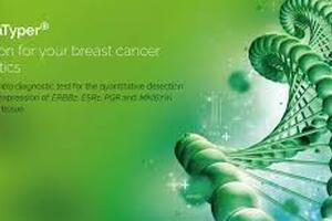 New test could herald breakthrough in breast cancer treatment