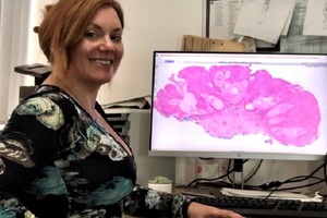 NHS Ayrshire & Arran Selects Philips digital pathology solution