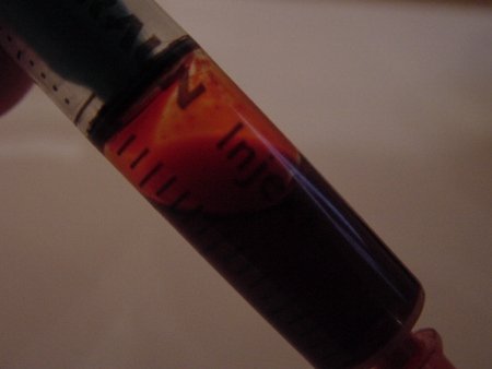 Nottingham hospitals first in world to install Apple iPod blood tracking system

