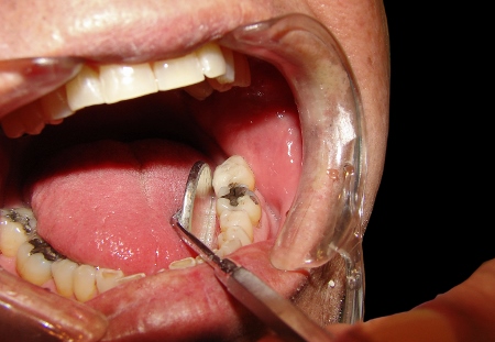 Probe into infection control at Scottish dental practices