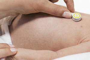 Radiometer launches the next generation of transcutaneous monitoring