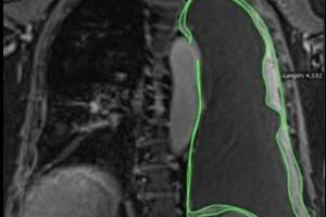 Scottish company begins research on AI-powered cancer assessment prototype