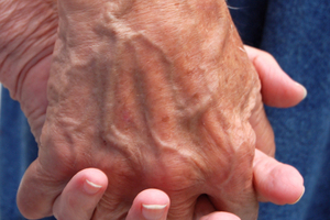 Specialist dementia care project given green light 
