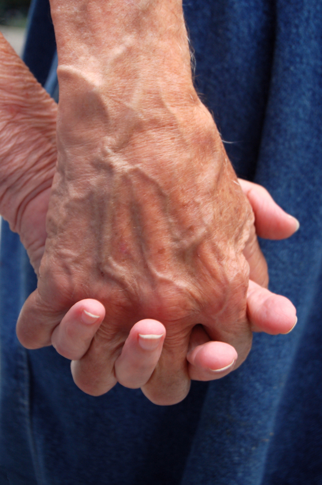 Specialist dementia care project given green light 