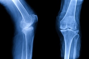 Supply chain shake-up saves more than £450,000