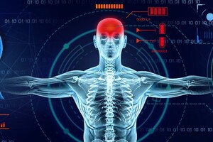 Wellbeing Software and Brainomix partner for stroke diagnosis