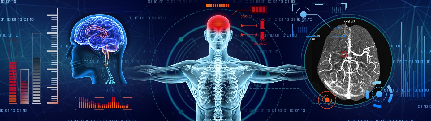 Wellbeing Software and Brainomix partner for stroke diagnosis